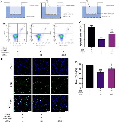 Acute Administration of Metformin Protects Against Neuronal Apoptosis Induced by Cerebral Ischemia-Reperfusion Injury via Regulation of the AMPK/CREB/BDNF Pathway